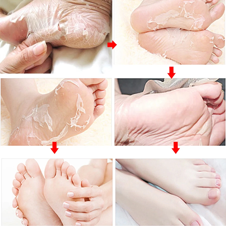 Esfolio Masca-Peeling pentru picioare