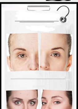 100g Coș de Demontare Masca Magnetice Nas Curatare Profunda a Pielii Faciale Frumusete Micsora Porii Albire Noroi Măști Pentru Îngrijirea Pielii