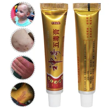 5 Buc/Set Original Chineză Pe Bază De Plante Medicament Unguent Tratament Psoriazis Crema De Piele Noua Pe Bază De Plante Psoriazis, Prurit Crema