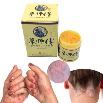 5pcs Naturale, Medicina Chineză pe bază de Plante Anti Bacterii Crema Psoriazis Eczeme Unguent Tratament de Înaltă Calitate pe bază de Plante Crema