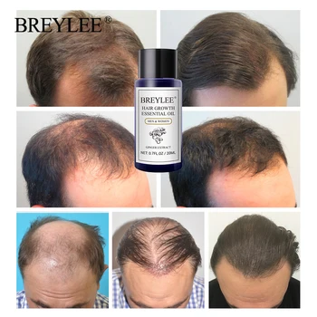 BREYLEE Cresterea Parului Ulei Esential 2 BUC Repede Puternice de Păr Produse de Îngrijire a Părului Preveni Chelie Anti-Hair Loss Ser Crește Părul