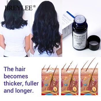 BREYLEE Cresterea Parului Ulei Esențial 20ml Repede Puternice de Păr Produse de Îngrijire a Părului Preveni Chelie Anti-Hair Loss Ser Hranitor