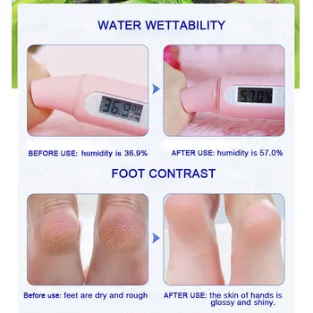 De mâini Și de Picioare Crema de Reparații Tradițională Chineză Ulei Anti-Uscare Glicerină, Alantoină, Pentru a Reduce Liniile uscate crema Hidratanta Mână de Îngrijire de Picioare