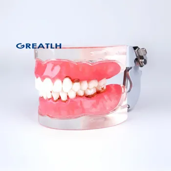 Dentare Adult Patologice Parodontale boala 4017# Dentare Typodont Dinți Model