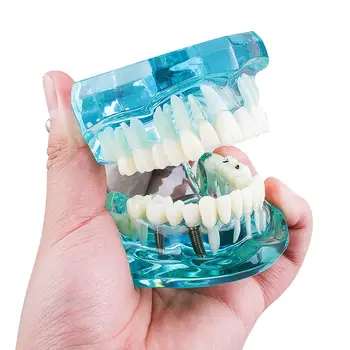 Dentare Studiu Dinte Model Adult Patologice de predare Dinți model nou denshine