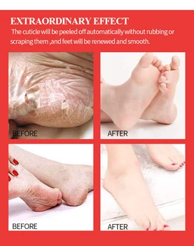 EFERO 5pairs Picior Peeling Masca de Piersici Hidratare, Exfoliere Cuticula Moarte ale Pielii de Îngrijire de Picioare Șosete Pedichiura Picior Masca pentru Picioare