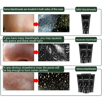 LANBENA Unisex Masti Faciale Scoate Nasul negru de Acnee Micsora Porii Tratament Coș de Hidratare Curatare Profunda de Îngrijire a Pielii