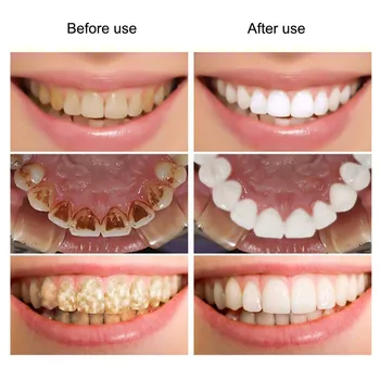 Naturale de Albire Pulbere Dinte Periaj Pulbere Înălbitor de Dinți Igienă Orală @ME88