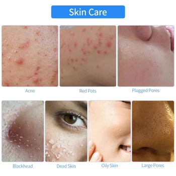Ultrasunete Facial Skin Scrubber Ion Adânc Curățarea Feței Peeling Reîncărcabilă de Înaltă frecvență de Vibrație Porilor Filtrului de Fata Epurator